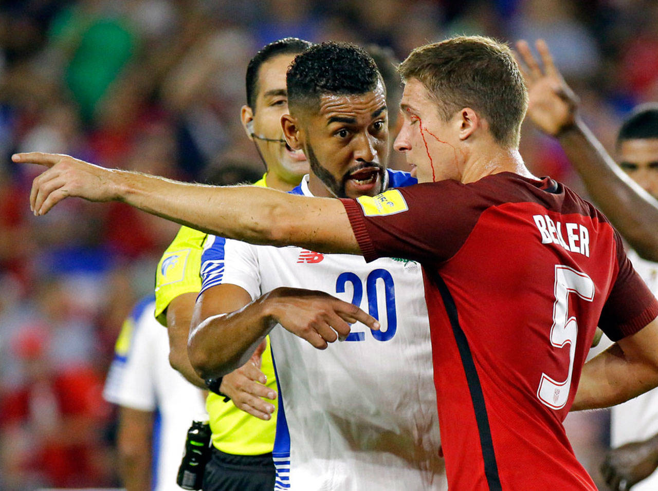 (AP Foto/John Raoux)