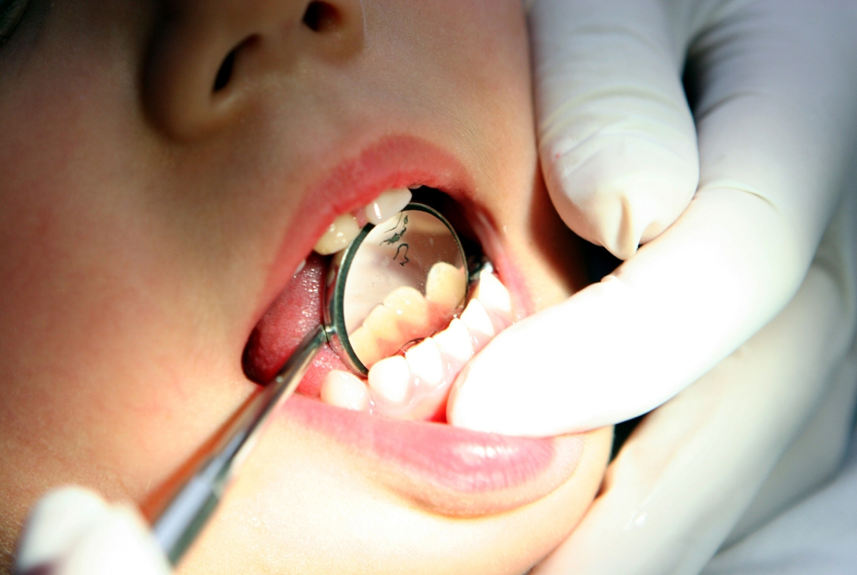 Antes de dormir, cep&iacute;llese los dientes