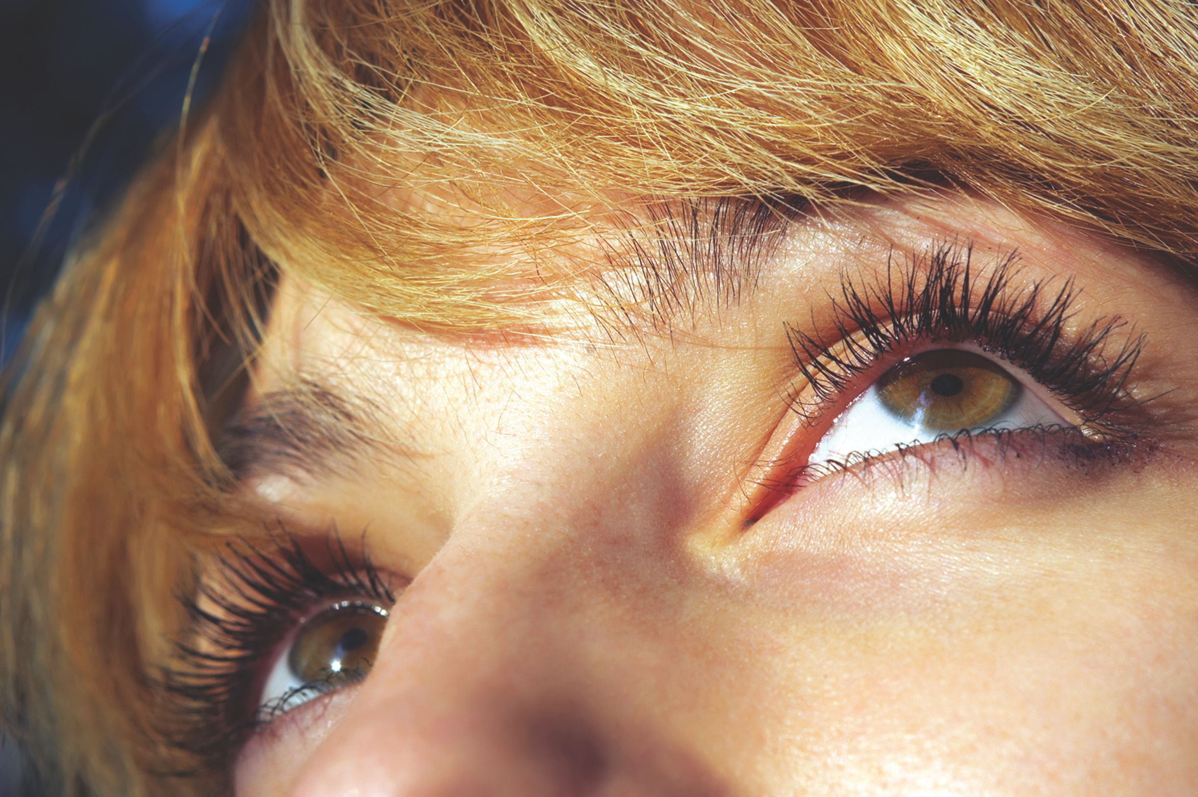 C&eacute;lulas troncales podr&iacute;an ayudar a la vista