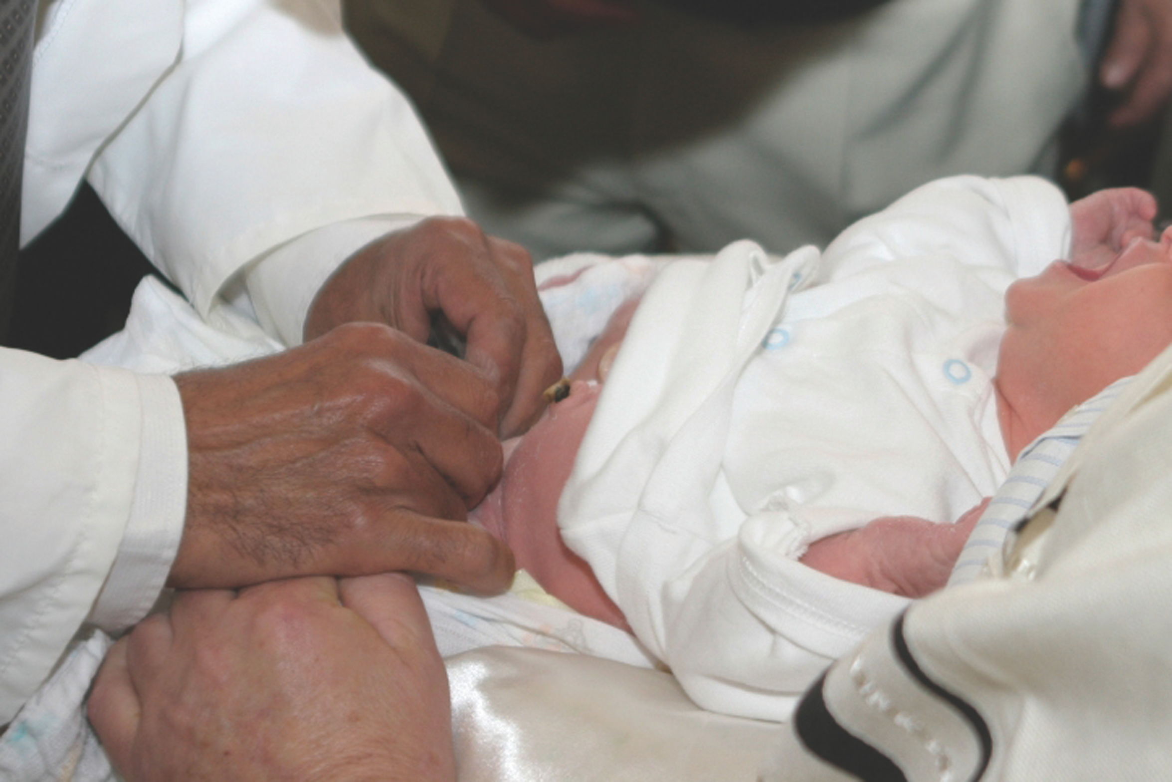 Los beneficios de la circuncisión superan los riesgos