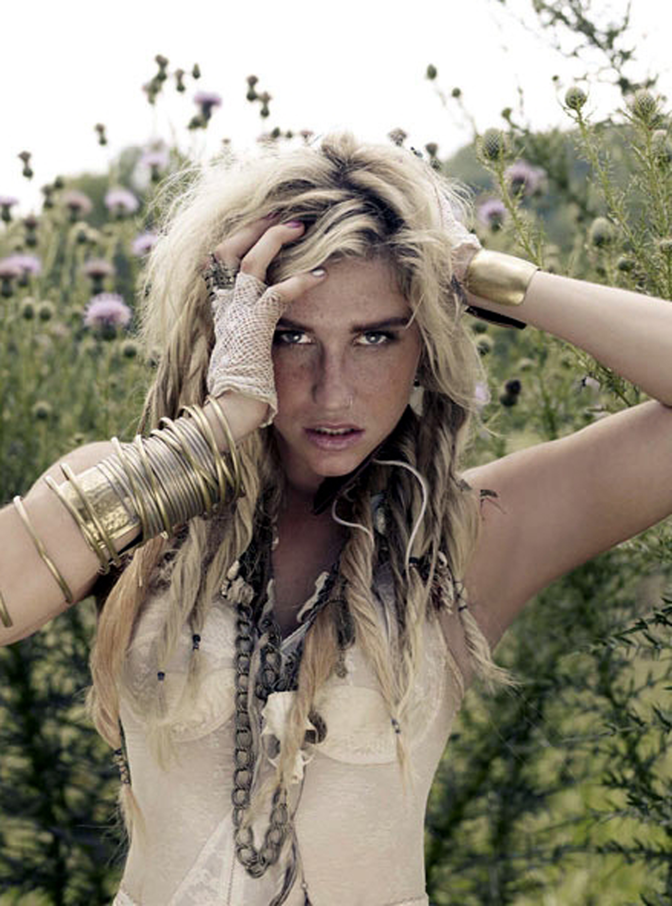 Sale Ke$ha de rehabilitaci&oacute;n