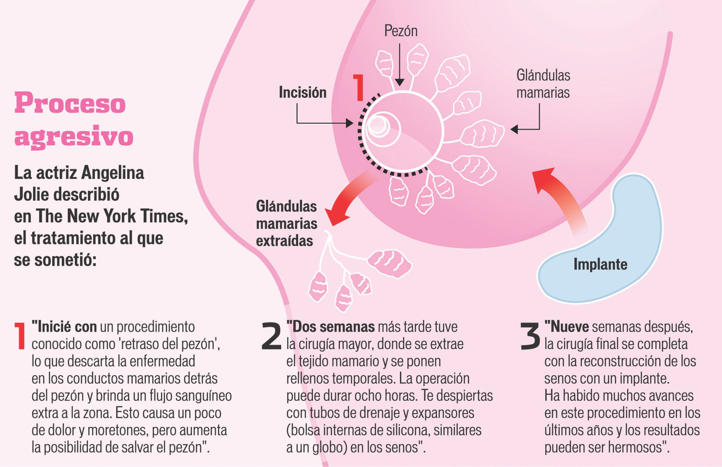 Refuerzan lucha para prevenir C&aacute;ncer de mama