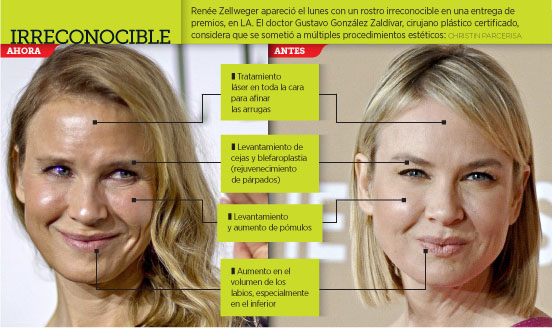 Molesta a productores cambio de Ren&eacute;e