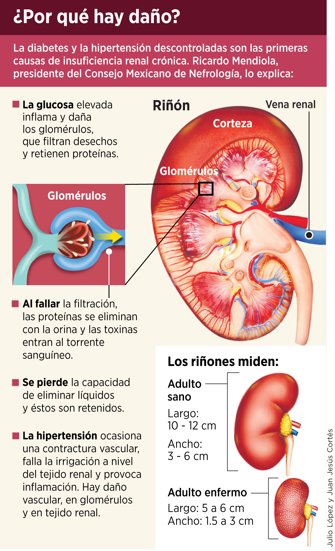 Salve sus ri&ntilde;ones; frene la diabetes