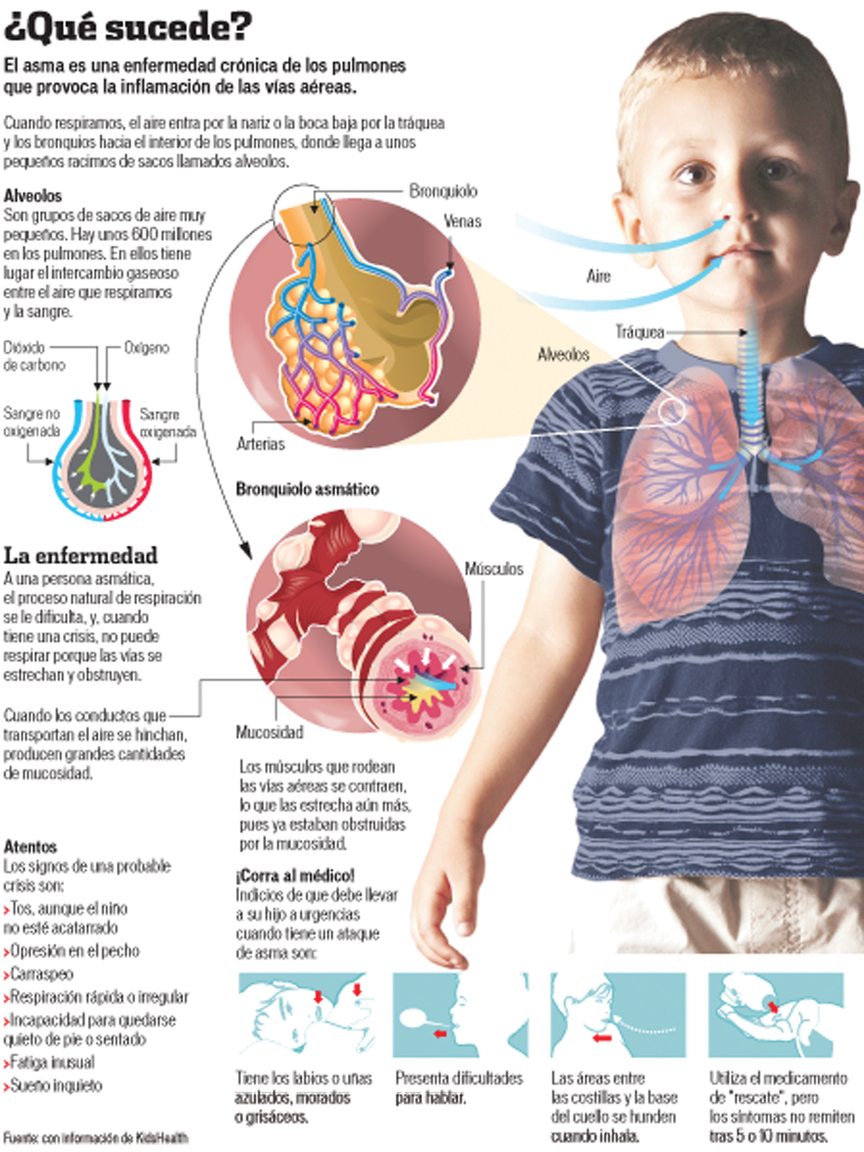 Asma infantil: un foco rojo