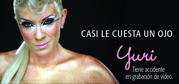 Se lastima Yuri ojo en video