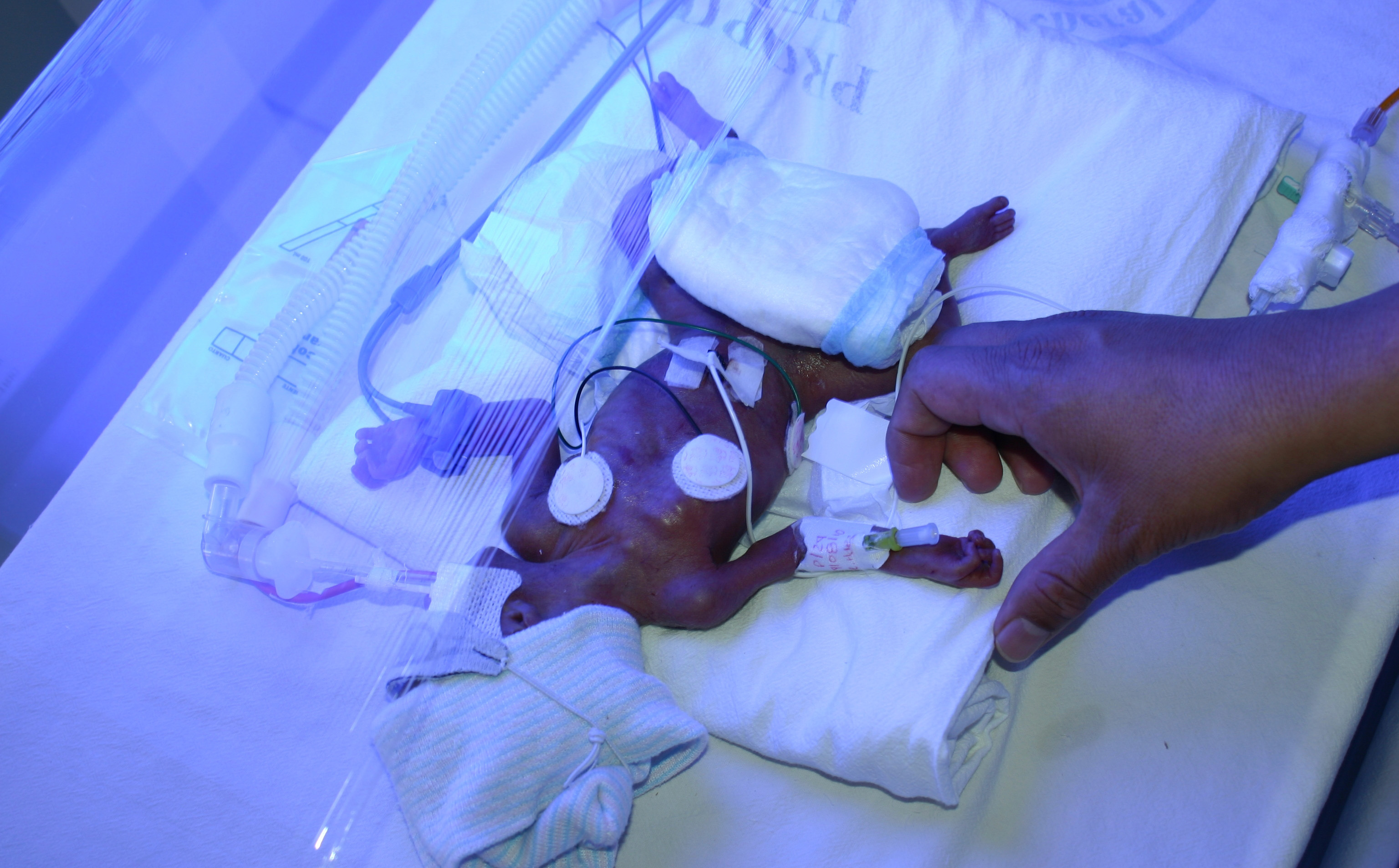 Beb&eacute; revive en un ata&uacute;d