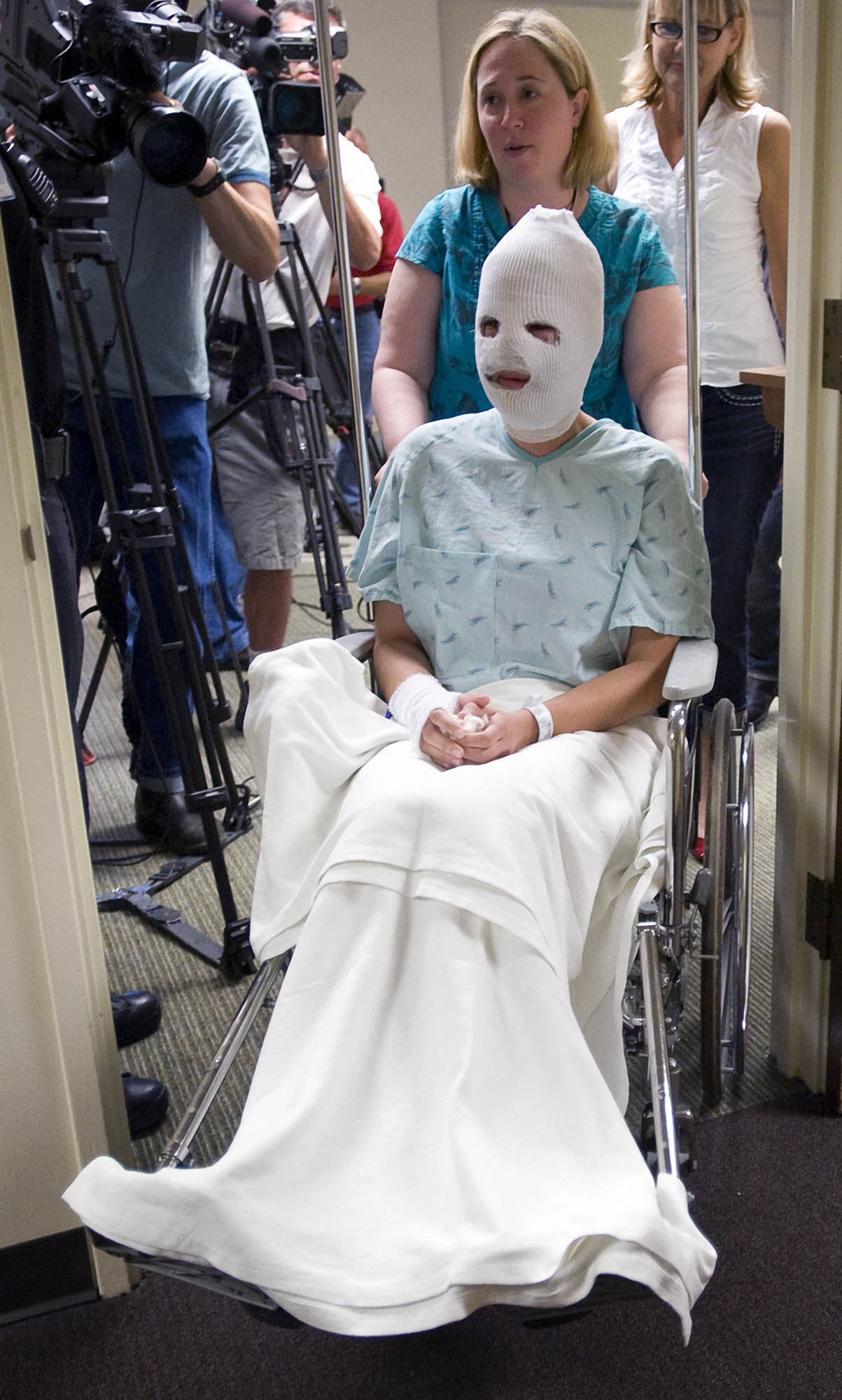 Ataque con &aacute;cido fue fingido